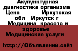 Акупунктурная диагностика организма › Цена ­ 2 100 - Иркутская обл., Иркутск г. Медицина, красота и здоровье » Медицинские услуги   